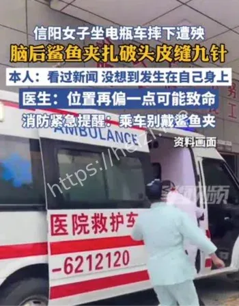 鲨鱼夹撕裂头皮事故